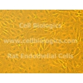 ZDF Rat Diabetic Spleen Endothelial Cells